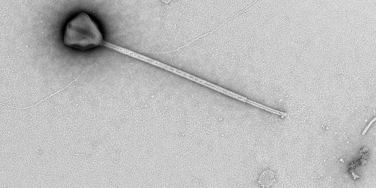 Giant virus
<span class="bsf-rt-reading-time"><span class="bsf-rt-display-label" prefix="დრო:"></span> <span class="bsf-rt-display-time" reading_time="2"></span> <span class="bsf-rt-display-postfix" postfix="წთ."></span></span><!-- .bsf-rt-reading-time -->